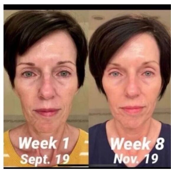 Mary Kay Clinical Solutions Box Set Age Fighting Skincare Retinol .5 Giftbox New - Picture 3 of 12